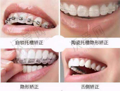苏州好牙口腔门诊部营业时间