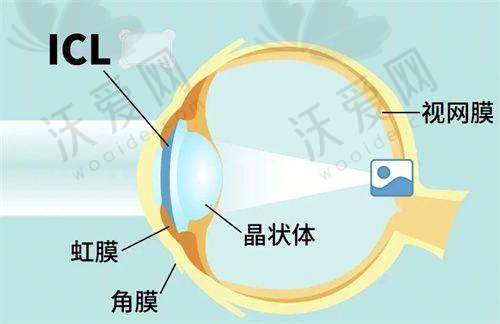上海和平眼科医院褚仁远医生技术好不好？