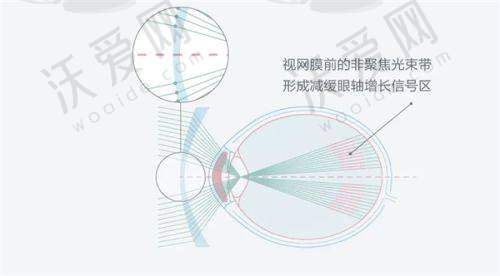 泸州合江爱尔眼科诊所地址