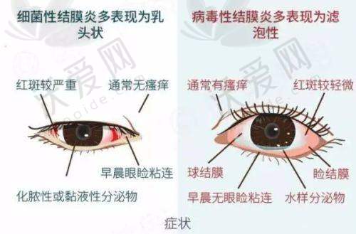 总结——云南昆明眼科医院袁俊彦医生怎么样？