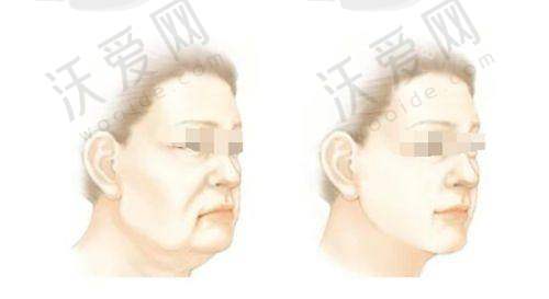 义乌阳光医疗美容医院技术好不好？