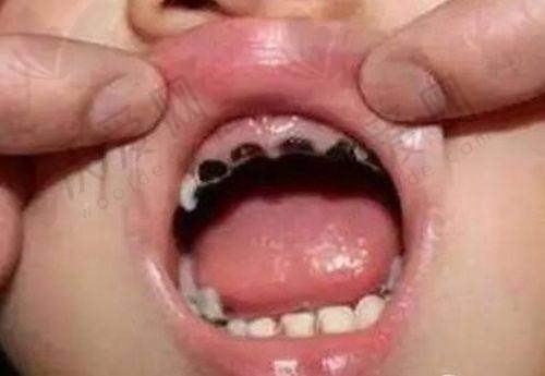 深圳善贝口腔的患者评价怎么样？