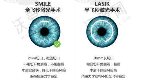 湛江爱尔奥理德眼科医院陈玄之医生技术好不好？