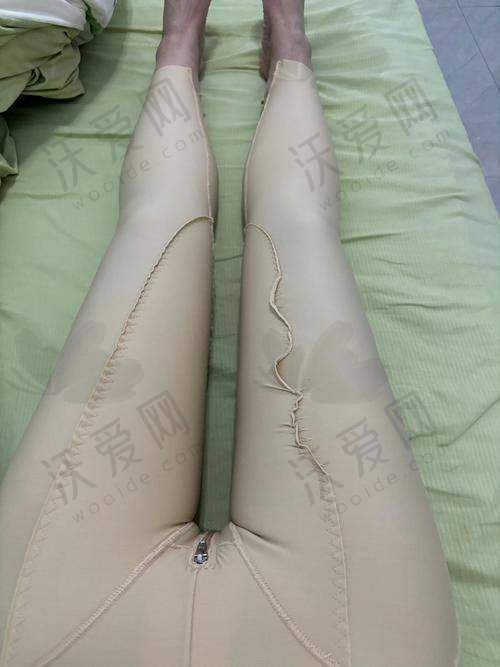 北京纯脂医疗美容门诊部常双明医生口碑评价如何？