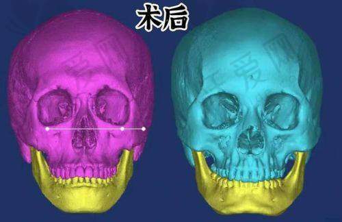 广州广大整形医院徐威强医生口碑评价如何？