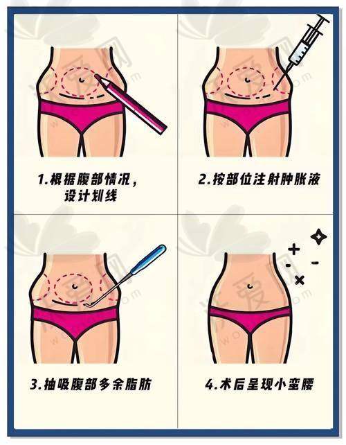 宁波海曙熙美医疗美容门诊部（吸脂专科）电话号码