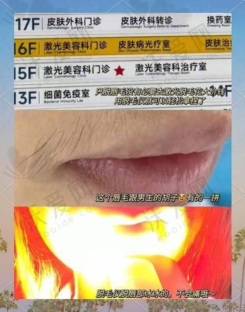 上海首尔丽格比基尼V区激光脱毛的作用和成效