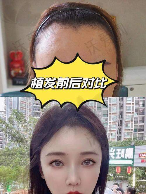 广州赫本熙朵医疗美容门诊部（植发专科）地址