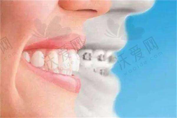 广州广大整形医院艾伟健医生简介
