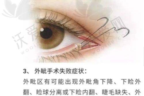 韩国Faceline整形外科——轮廓整形佼佼者
