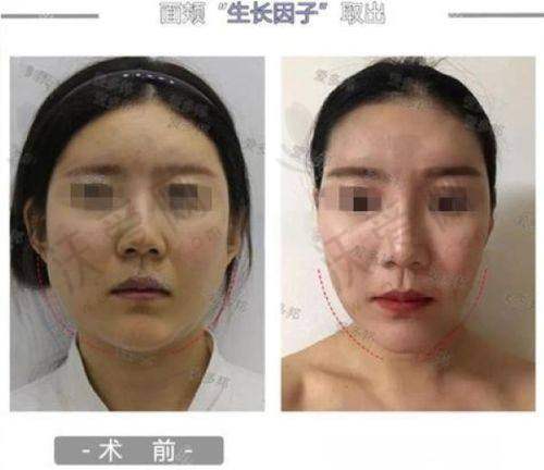 韩国TS整形外科医院——独特风格的整形医院