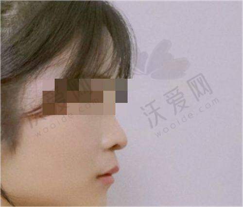 哈尔滨濡白天使认证正规便宜医师查询之杨宇梓-哈尔滨羽禅医疗美容