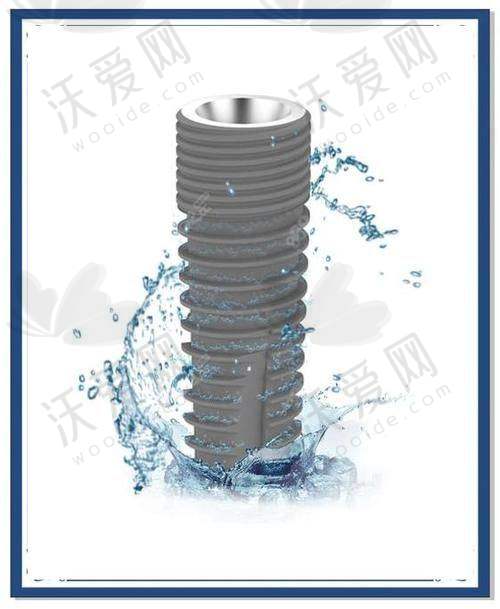 西安新城团圆口腔瑞士ITI纯钛种植牙价格5525元起一颗，种牙快稳美还有省钱攻略！