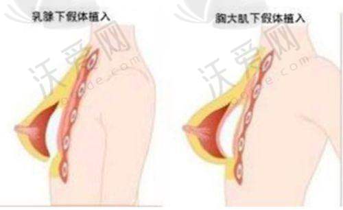深圳悦尔医疗美容门诊部收费标准参考