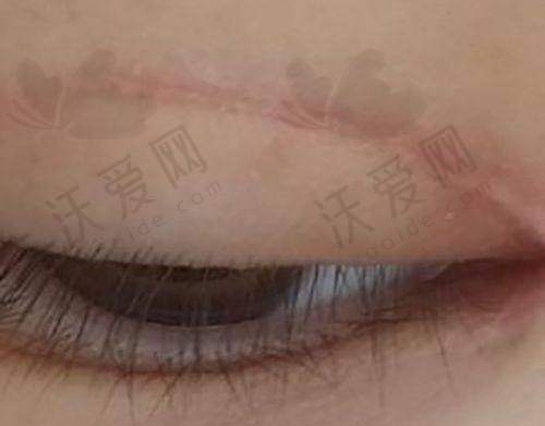 烟台壹美天成医疗美容医院收费标准参考