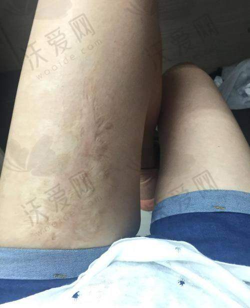 深圳悦尔医疗美容的整体优势有哪些？