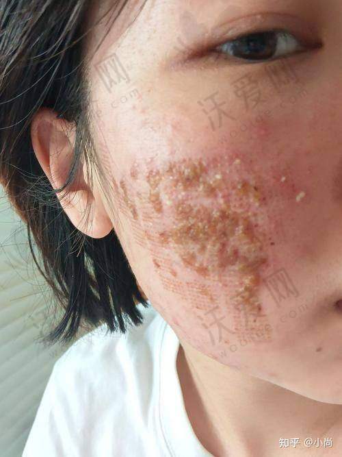 深圳悦尔医美是一家怎样的医院？