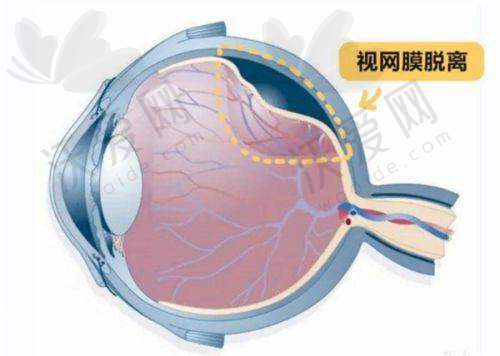总结评价——昆明阿玛施眼科全飞秒激光中 心怎么样？