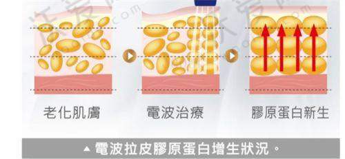 四川省成都市成都新华医院整形外科罗通贵医生技术好不好？