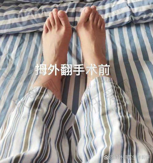 沈阳和平马文足科整形外科门诊部‌曹海锟医生挂号预约攻略