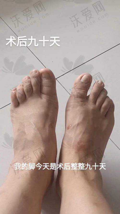 沈阳和平马文足科整形外科门诊部‌曹海锟医生技术好不好？