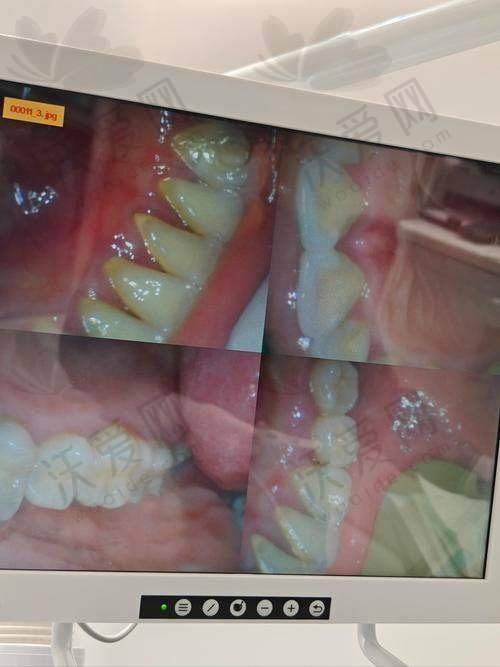 长春传阳口腔其他口腔项目收费标准参考