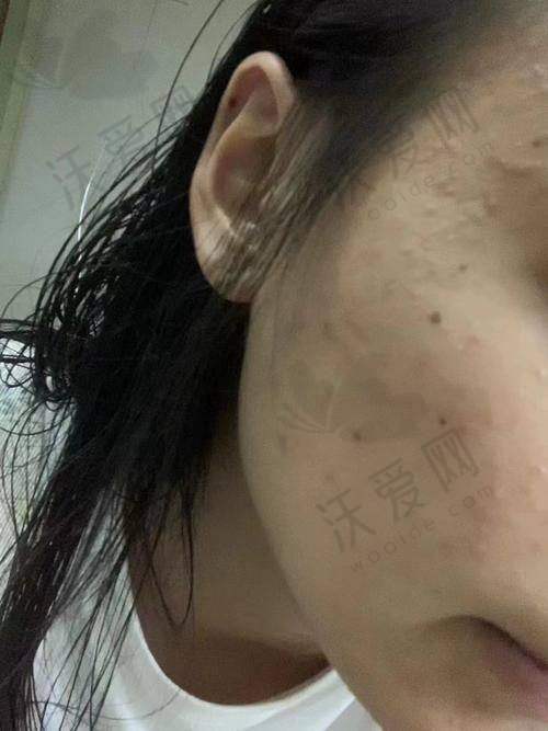 乌鲁木齐华美整形美容医院收费标准参考