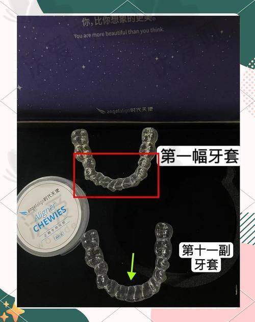 西安团圆口腔医院时代天使隐形矫正的医生团队