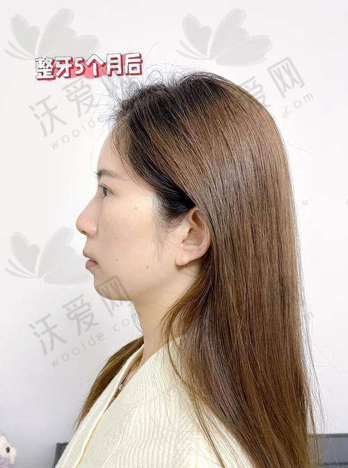 西安团圆口腔医院其他口腔项目收费标准参考