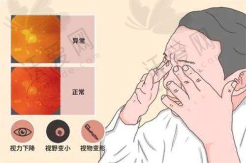 上海浦东爱尔眼科ICL晶体植入技术有哪些优势？