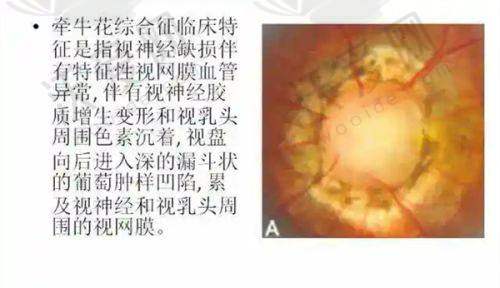 辽宁抚顺爱尔眼科医院方学军 医生口碑评价如何？