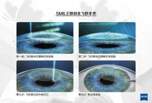 抚顺爱尔眼科医院在服务方面表现如何？