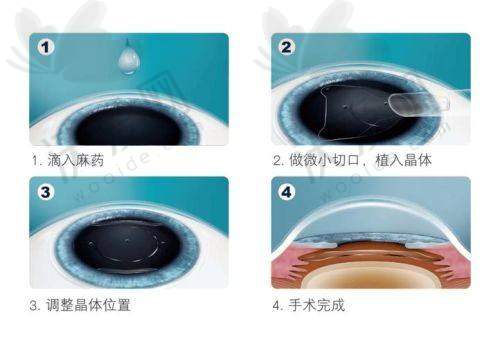 昆明华厦眼科医院的实力如何？