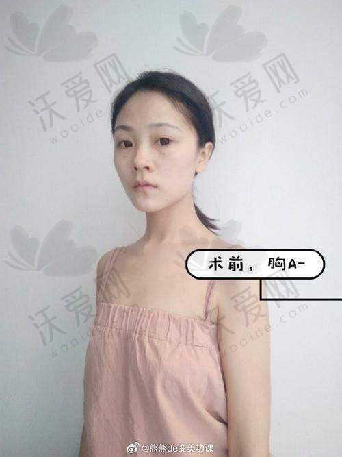 总结