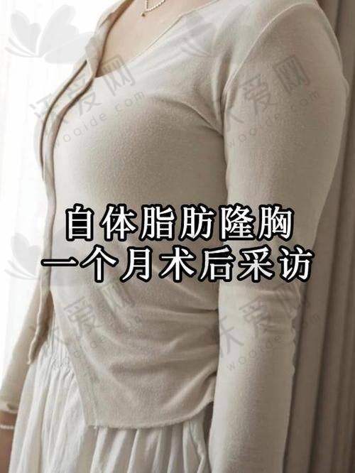 乌鲁木齐华美整形自体脂肪隆胸技术优势