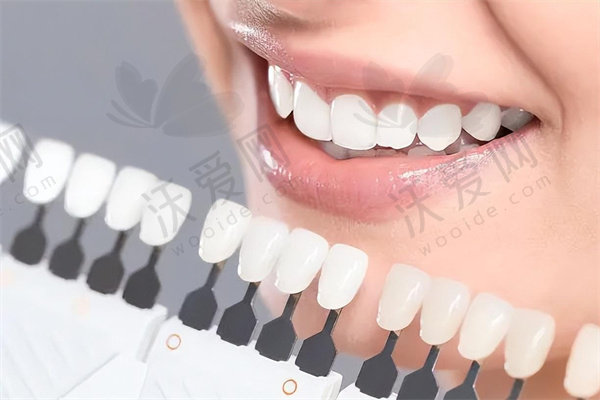 盐城中喜口腔四环素牙治疗680元起，做前到底要不要提前预约呢