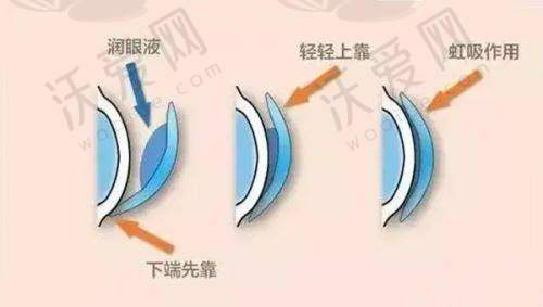 南宁华厦眼科小儿斜视项目之医生团队