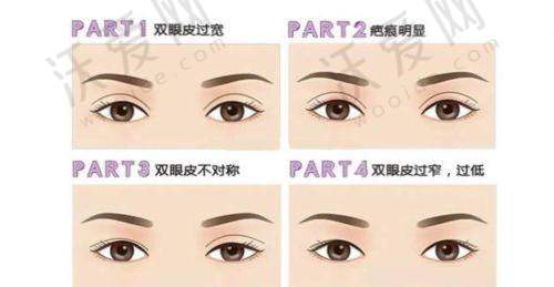 上海华美佀同帅医生眼部整形与修复之预约方式
