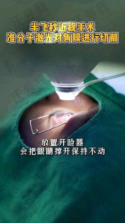 成都华厦眼科医院准分子激光近视手术的适应人群