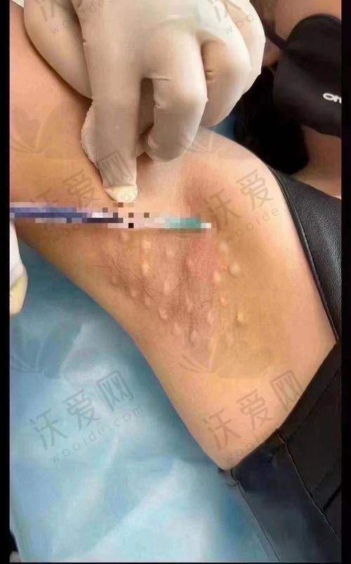 广州荔医医疗美容的整体正规可靠性