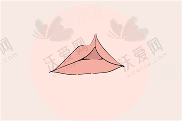 余文林做唇裂修复怎么样？
